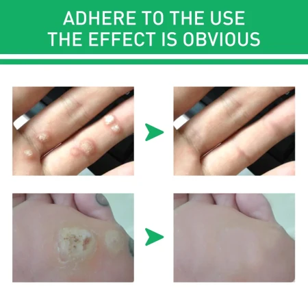 First slide