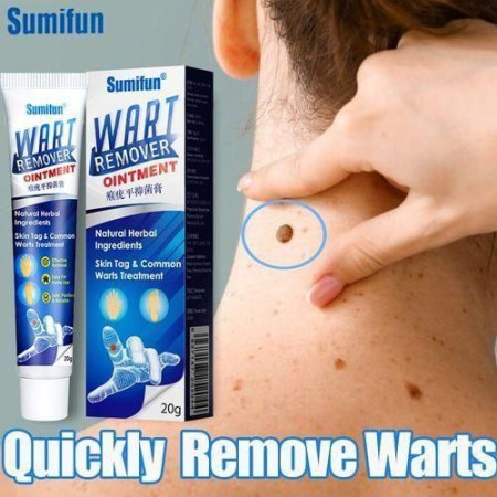 Wart Removal Cream 20g